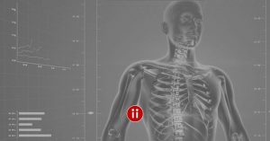 X-Ray Suche im Active Sourcing