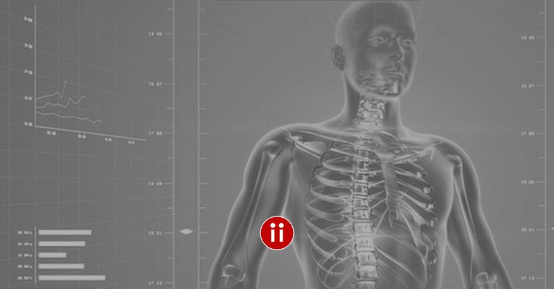 X-Ray Suche im Active Sourcing